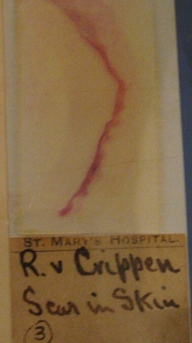Dr Hawley Crippen Hilldrop Crescent hyoscine murder trial portrait