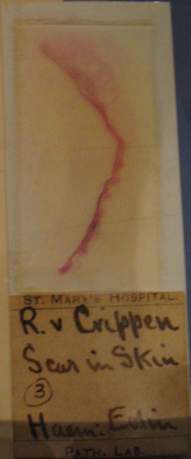 Dr Hawley Crippen Hilldrop Crescent hyoscine murder trial portrait